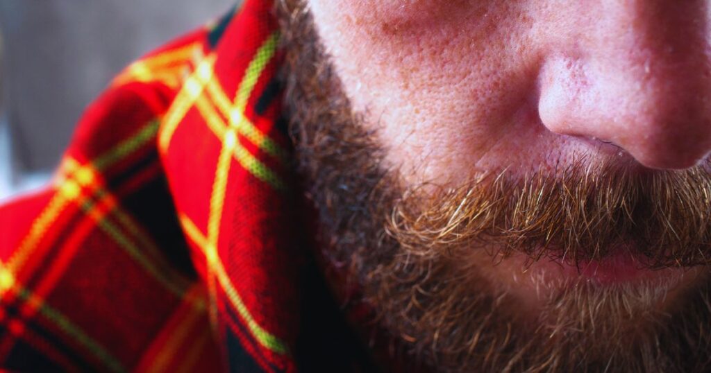 beard growth phase experiencing beard itch 